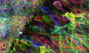 Protein-retention expansion microscopy of cells and tissues labeled ...